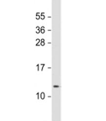 Westen blot testing of human lung lysate with RIG antibody at 1:1000. Predicted molecular weight: 12