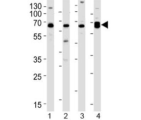 Western blot testing of 1) human Daudi, 2) human HL-60, 3) mouse brain and 4) mouse heart lysate wit