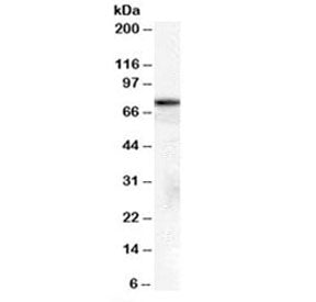 Western blot testing of A431 cell lysate with HSPA8 antibody at 2ug/ml. Predicted molecular weight: