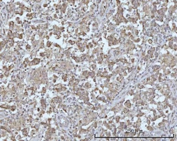 IHC staining of FFPE human testicular seminoma tissue with BCAP antibody. HIER: boil tissue sections