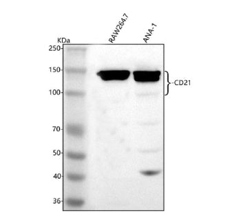 Western blot analysis of CD21/CR2 using anti-CD21 antibody. Lane 1: mouse Raw264.7 whole cell lysate