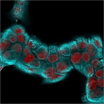 Immunofluorescent staining of permeabilized human MCF7 cells with recombinant Cytokeratin 18 antibod