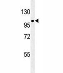 ZEB1 antibody western blot analysis in A549 lysate. Predicted molecular weight ~124 kDa but observed