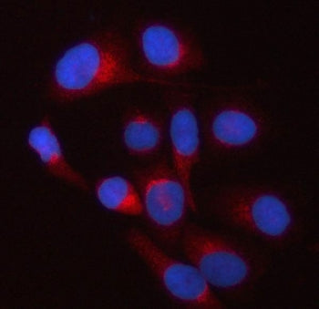 TWF2 Antibody / Twinfilin 2 / PTK9L