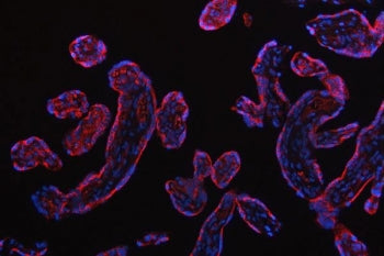 Immunofluorescent staining of FFPE human placental tissue with Small ribosomal subunit protein uS7 a