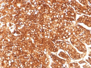 P Glycoprotein Antibody / MDR1 / ABCB1