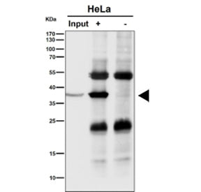 Immunoprecipitation analysis using the NMI antibody at 1:50 dilution (Western blot at 1:1000 dilutio