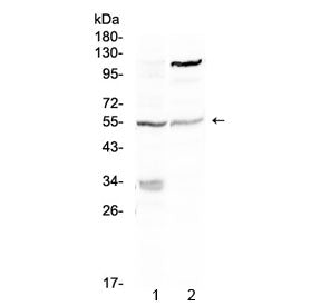 Western blot testing of 1) mouse NIH3T3 and 2) human A375 lysate with ETS1 antibody at 0.5ug/ml. Pre