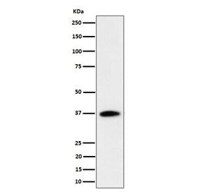Western blot testing of human Jurkat cell lysate with RASSF2 antibody. Predicted molecular weight ~3