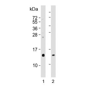 Western blot testing of human 1) kidney and 2) pancreas lysate with REG3G antibody. Expected molecul
