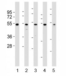 Western blot testing of NFKBIE antibody at 1:2000 dilution. Lane 1: PC3 lysate; 2: A375 lysate; 3: H