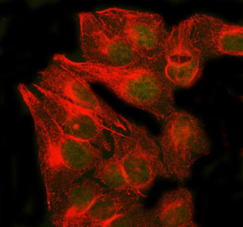 Immunofluorescent staining of RAD51B using anti-RAD51B antibody (green) and anti-Beta Tubulin antibo