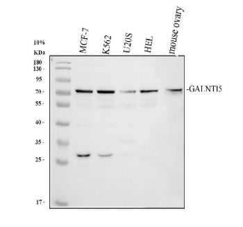 Western blot analysis of GALNT15 using anti-GALNT15 antibody. Electrophoresis was performed on a 10%
