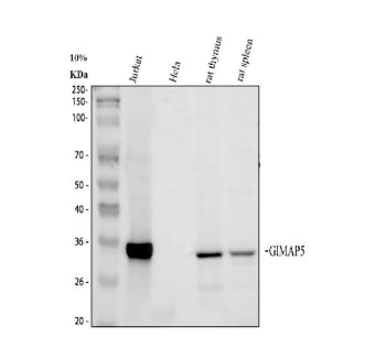 Western blot analysis of GIMAP5 using anti-GIMAP5 antibody. Electrophoresis was performed on a 10% S