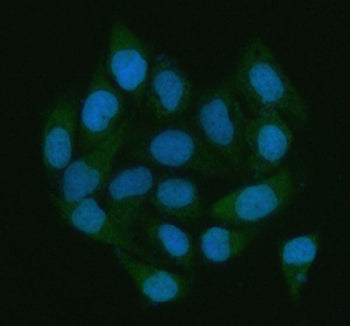 Immunofluorescent staining of LGALS3BP using anti-LGALS3BP antibody (green). LGALS3BP was detected i