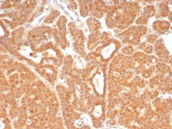 c-RET Antibody