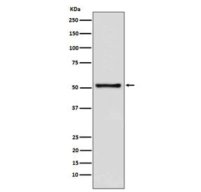 Western blot testing of human Jurkat cell lysate with TdT antibody. Predicted molecular weight ~56 k