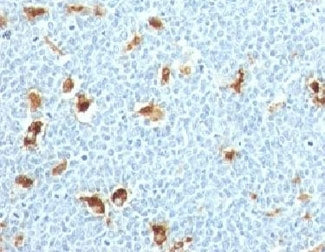 S100A9 Antibody / MRP14 / Calgranulin B / Calprotectin L1H