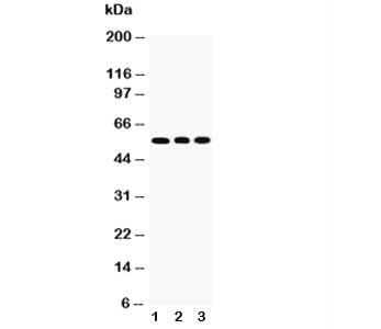 Western blot testing of KLF4 antibody and Lane 1: HeLa; 2: A549; 3: U20S cell lysate. Predicted mole