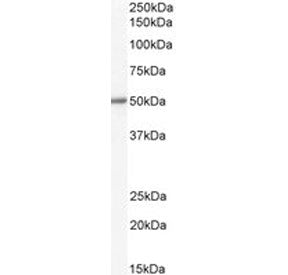 Western blot testing of human liver lysate with ALDH1B1 antibody. Predicted molecular weight: ~57 kD