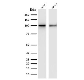 Western blot testing of human HeLa and MCF-7 lysate with ENAH antibody. Predicted molecular weight ~