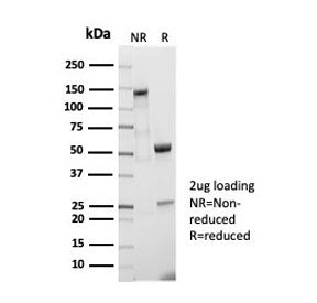 SDS-PAGE analysis of purified recombinant CD5 antibody (clone C5/7020R) as confirmation of integrity