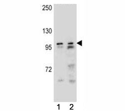 AR antibody western blot analysis in (1) NCI-H292, and (1) NCI-H460 lysate. Predicted molecular weig