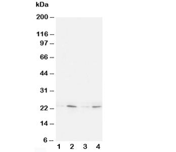 Western blot testing of HMGB4 antibody and Lane 1: rat brain; 2: rat testis; 3: (h) Jurkat; 4: (h) H