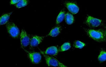 AK2 Antibody / Adenylate kinase 2