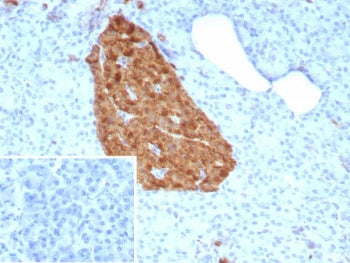 NSE Antibody / Neuron Specific Enolase