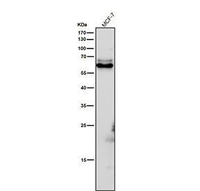 All lanes use the Phospho-CRMP2 (Thr514) antibody at 1:6000 dilution for 1 hour at room temperature.