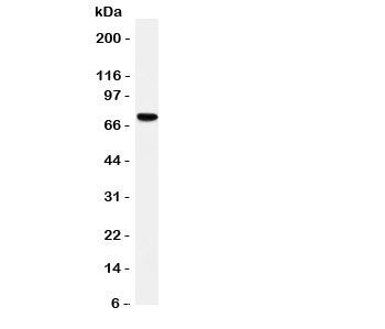 Western blot testing of HIF-3 alpha antibody and rat brain tissue lysate. Expected/observed size ~72