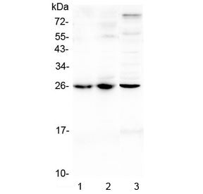 Western blot testing of 1) mouse lung, 2) mouse spleen and 3) rat spleen lysate with Trem1 antibody