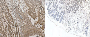 IHC testing of FFPE human heart tissue with NKX2.5 antibody (left) and without NKX2.5 antibody (righ