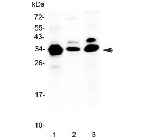 Western blot testing of 1) human COLO320, 2) rat spleen and 3) mouse NIH3T3 lysate with IL-1 beta an