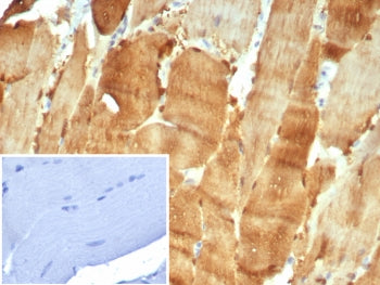 IHC staining of FFPE human skeletal muscle tissue with Carbonic Anhydrase 3 antibody (clone CA3/7884