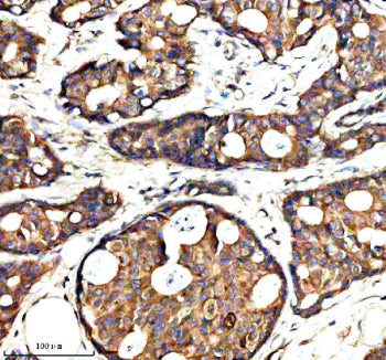 Immunohistochemical staining of SYAP1 using anti-SYAP1 antibody. SYAP1 was detected in a paraffin-em