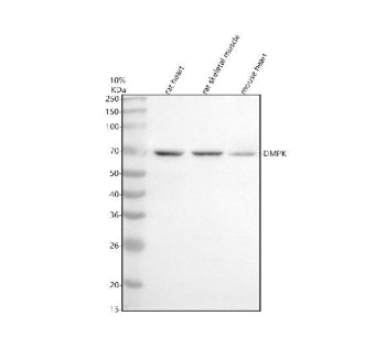 Western blot analysis of DMPK using anti-DMPK antibody. Electrophoresis was performed on a 10% SDS-P