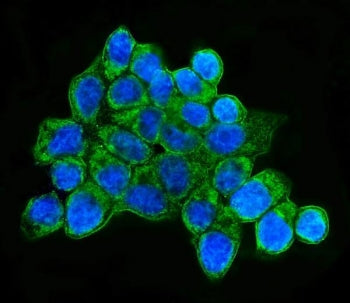 HLA-DQB1 Antibody