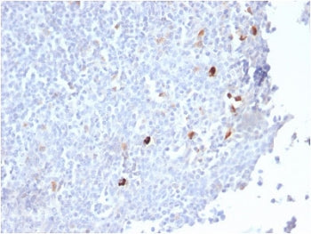 IHC staining of FFPE human tonsil tissue with recombinant IgM antibody (clone IGHM/2559R). HIER: boi