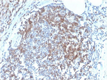 IHC staining of FFPE human tonsil tissue with recombinant CD6 antibody (clone C6/2884R). HIER: boil