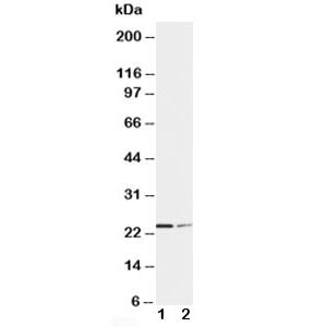 SOCS1 Antibody