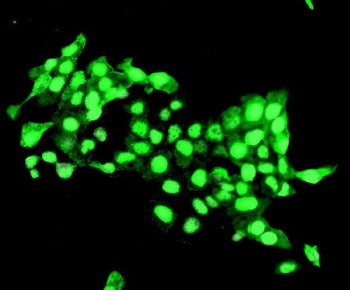 DELE Antibody / DELE1 / KIAA0141