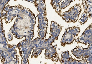 MUC1 Antibody / Mucin-1