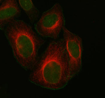 Immunofluorescent staining of FOXM1 using anti-FOXM1 antibody (green) and anti-Beta Tubulin antibody