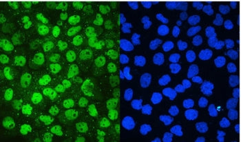 IF/ICC staining of FFPE human A431 cells with MCM2 antibody (green) at 2ug/ml and DAPI nuclear stain