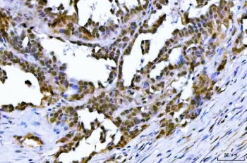 TIF1 gamma Antibody / TRIM33