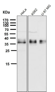 All lanes use the GGH antibody at 1:1000 dilution for 1 hour at room temperature. Western blot analy