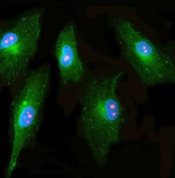 NNP1 Antibody / Novel nuclear protein 1 / RRP1