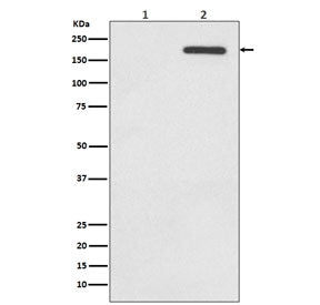 Western blot testing of lysate from human A431 cells 1) untreated and 2) treated with EGF, with phos